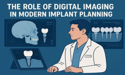 The Role of Digital Imaging in Modern Implant Planning